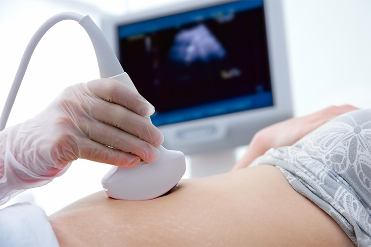 En qué semana se debe realizar una ecografía doppler en el embarazo? -  Ginefem