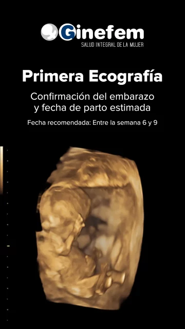 ecografía