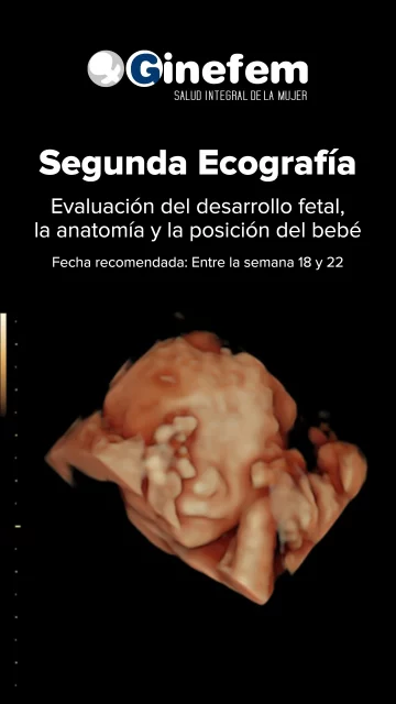 ecografía