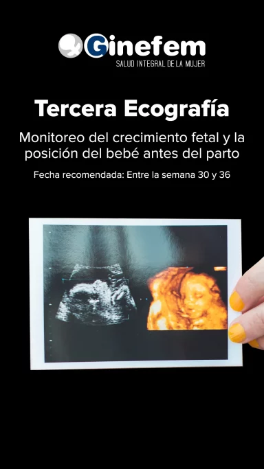 ecografía