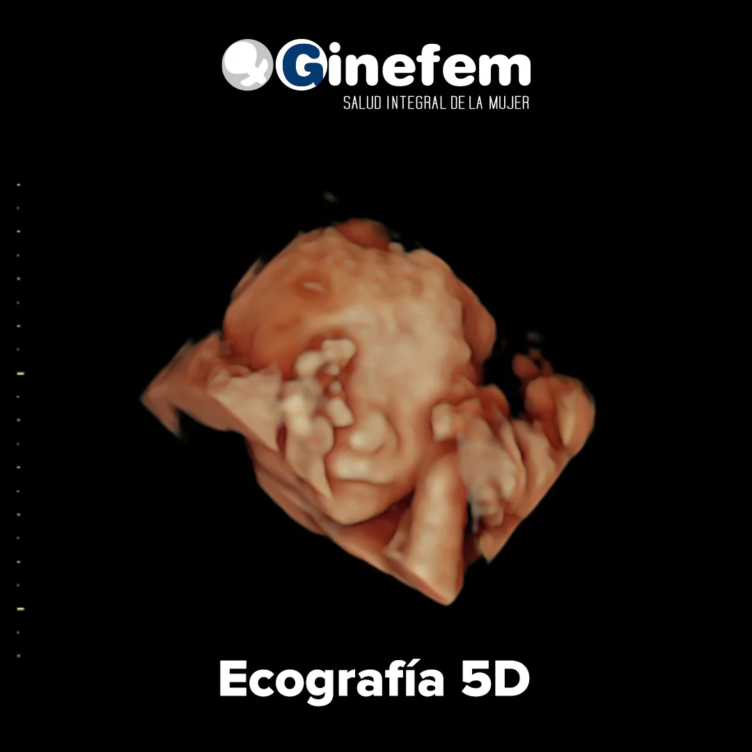 Ecografia-5D-IG